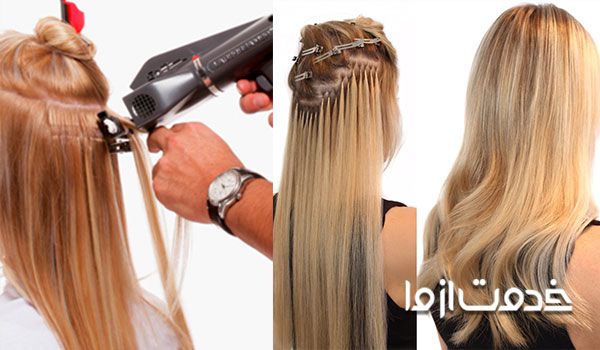 فواید اکستنشن مو با لیزر - نحوه کاشت مو با اکستننشن لیزری مو