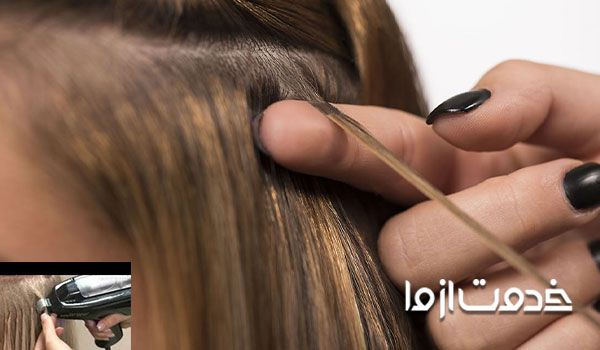 فواید اکستنشن مو با لیزر - نحوه کاشت مو با اکستننشن لیزری مو