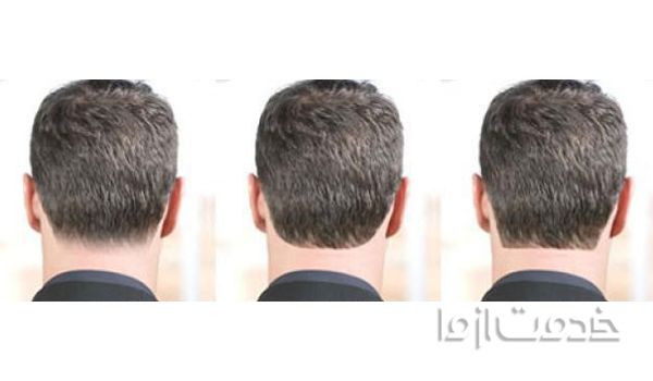 آموزش خط گردن