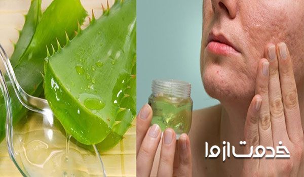 درمان خارش پوست بعد از اصلاح با الوئه ورا