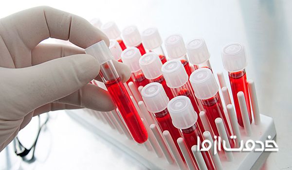 چگونه جواب آزمایش خون را بخوانیم؟