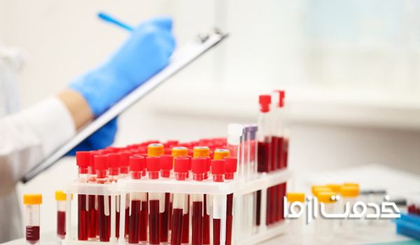 چگونه جواب آزمایش را بفهمیم