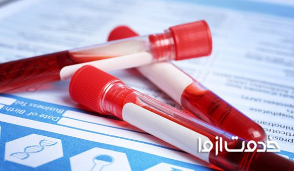 جدول جواب آزمایش