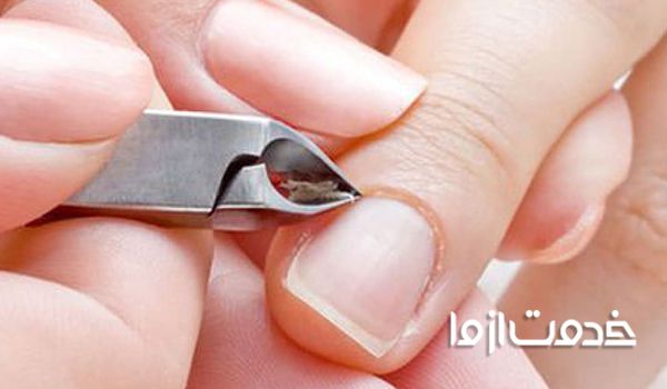 پوسته شدن اطراف ناخن در کودکان