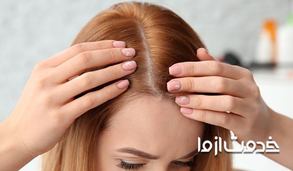 علت نازک شدن موی سر - نازک شدن پوست سر