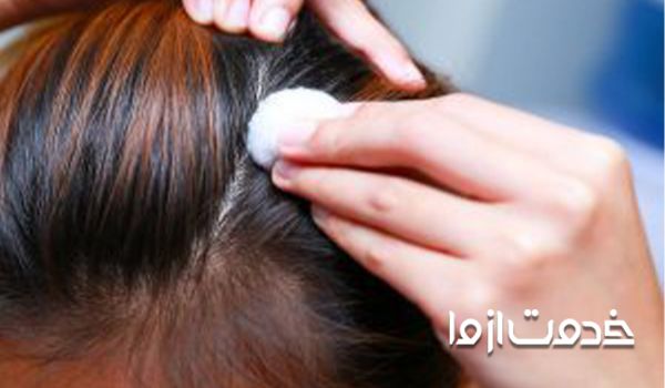 علت نازک شدن موی سر -درمان نازک شدن مو در طب سنتی