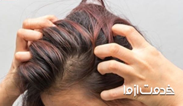 دلیل سست شدن ریشه مو- علت نازک شدن پوست سر