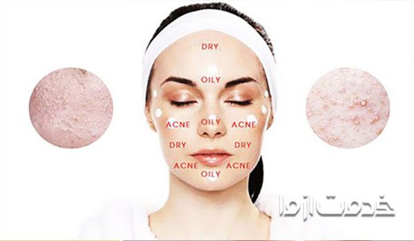 ناحیه تی زون صورت کجاست؟