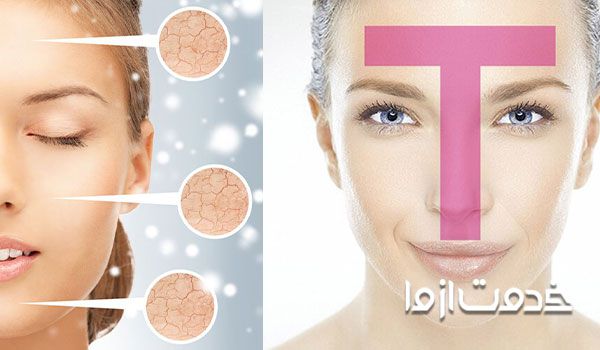 تی زون صورت و شناخت جنس ترکیبی پوست صورت