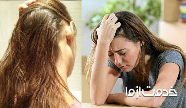 چرب شدن موی سر