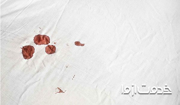 پاک کردن لکه خون