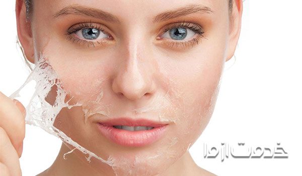 فشیال صورت چیست؟