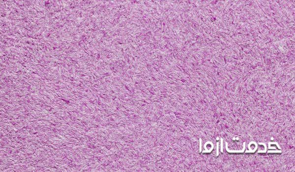 رنگ رومالین چیست