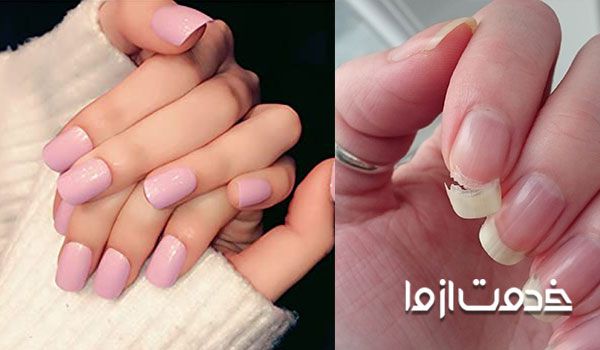  ترمیم ناخن شکسته با چند روش ساده 