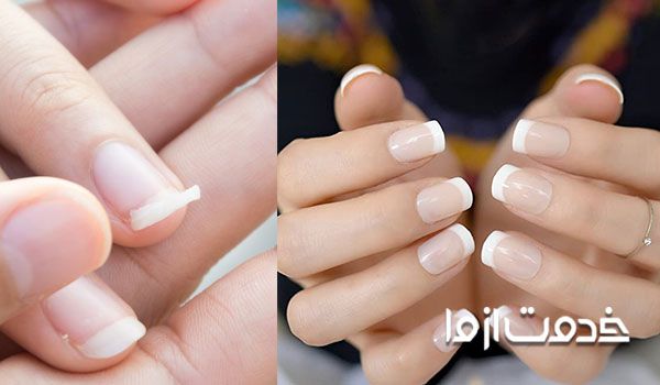 4 روش ترمیم ناخن شکسته در منزل
