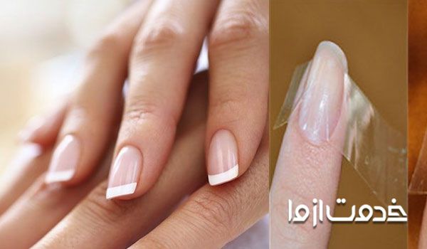 ترمیم ناخن شکسته کاشت با چسب شیشه‌ای