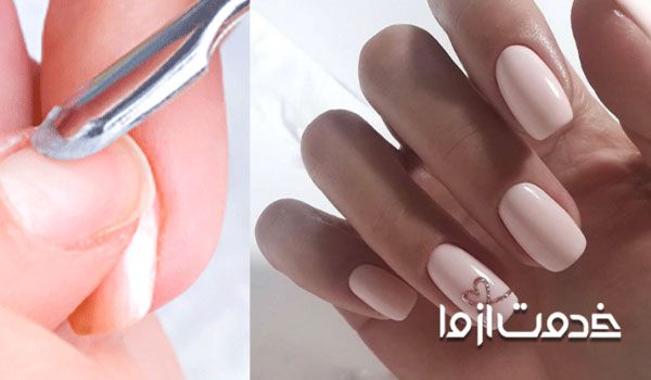 چند راهکار برای ترمیم ناخن شکسته کاشت