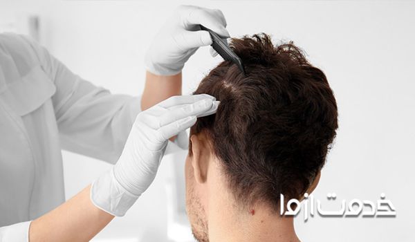 ترمیم مو سر چیست و مزایای آن