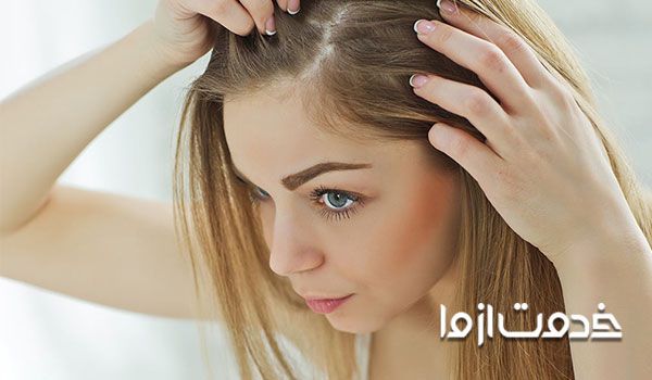 شپش سر را چگونه از بین ببریم