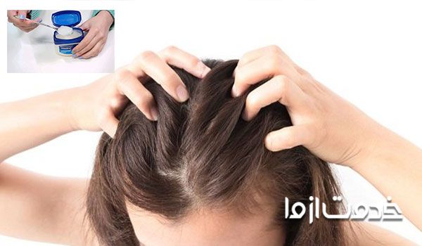 پاکسازی شپش مو با سشوار