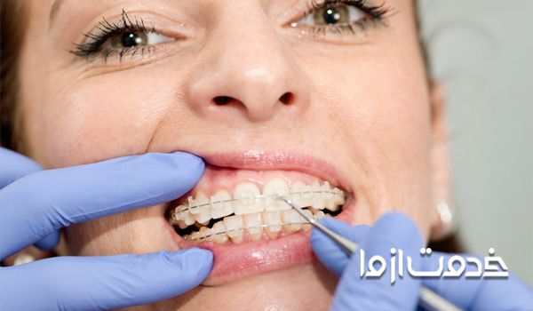 دکتر ارتودنسی تهران