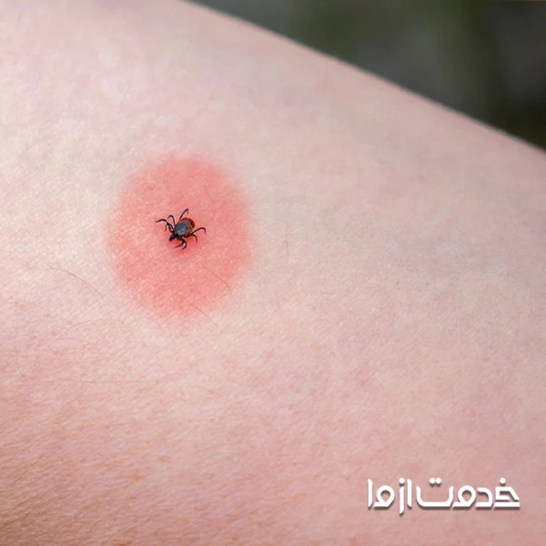 علائم وجود کنه در خانه