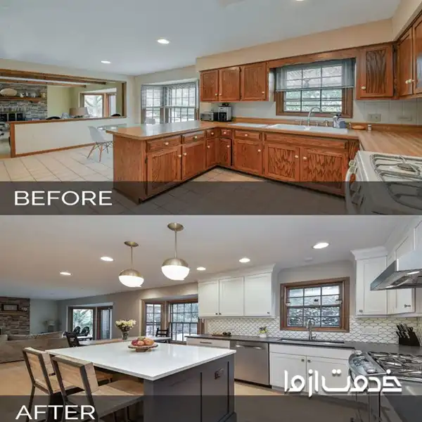 بازسازی اوپن قبل و بعد