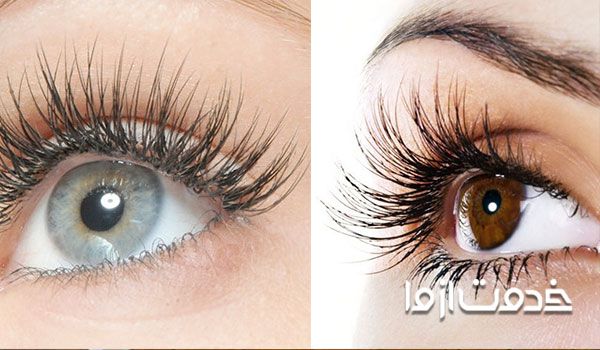 کاشت مژه هیدن چیست؟