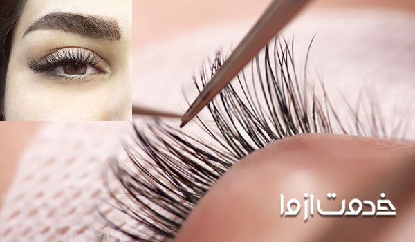 کاشت مژه کلاسیک