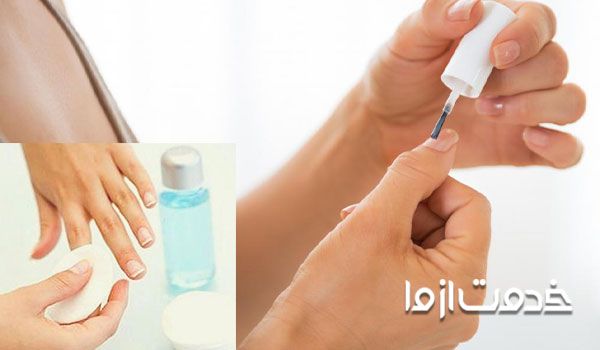 علت لکه سفید روی ناخن چیست؟ - آلرژی ها