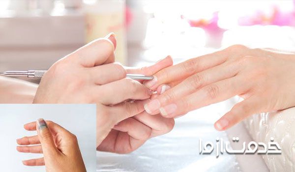 علت لکه سفید روی ناخن چیست؟  زخم ها آسیب های ناشی از آن 