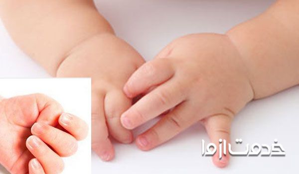 لک سفید روی ناخن بچه