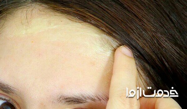 چطور لکه رنگ مو را از پوست و وسایل پاک کنیم