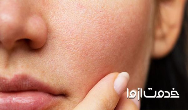 راهکارهای مفید برای بستن منافذ پوست صورت