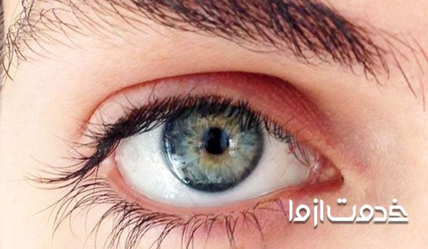 معجزه رشد مژه