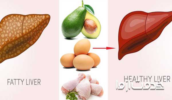 کبد چرب را چگونه درمان کنیم؟