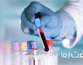 چگونه جواب آزمایش خون را بخوانیم؟