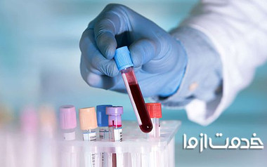 چگونه جواب آزمایش خون را بخوانیم؟