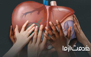 کبد چرب و انواع آن (گرید 1، 2 و 3)