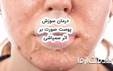 درمان سوزش پوست صورت بر اثر سمپاشی