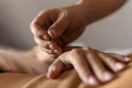 طب سوزنی در منزل در اصفهان