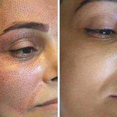 resume image