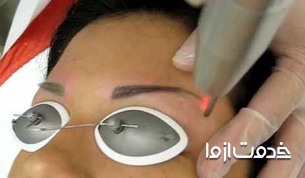 پاك كردن تاتو ابرو با سير در منزل 