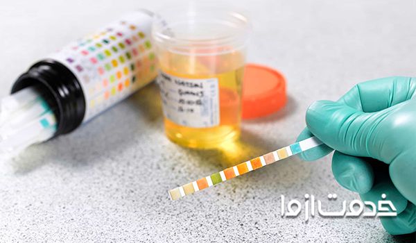 آزمایش تست اعتیاد در منزل