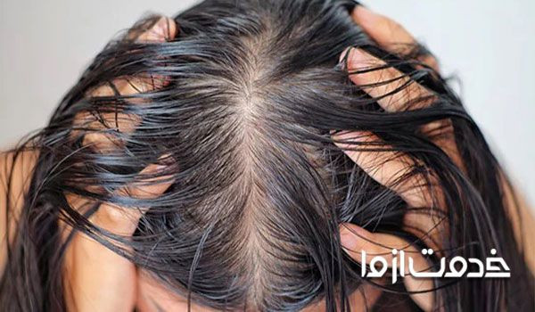 آشنایی با علل چربی موی سر