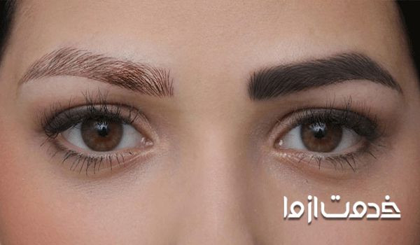 عوارض هاشور ابرو